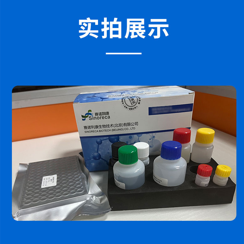 1.jpg 小反刍兽疫病毒酶联抗体检测试剂盒使用方法及注意事项